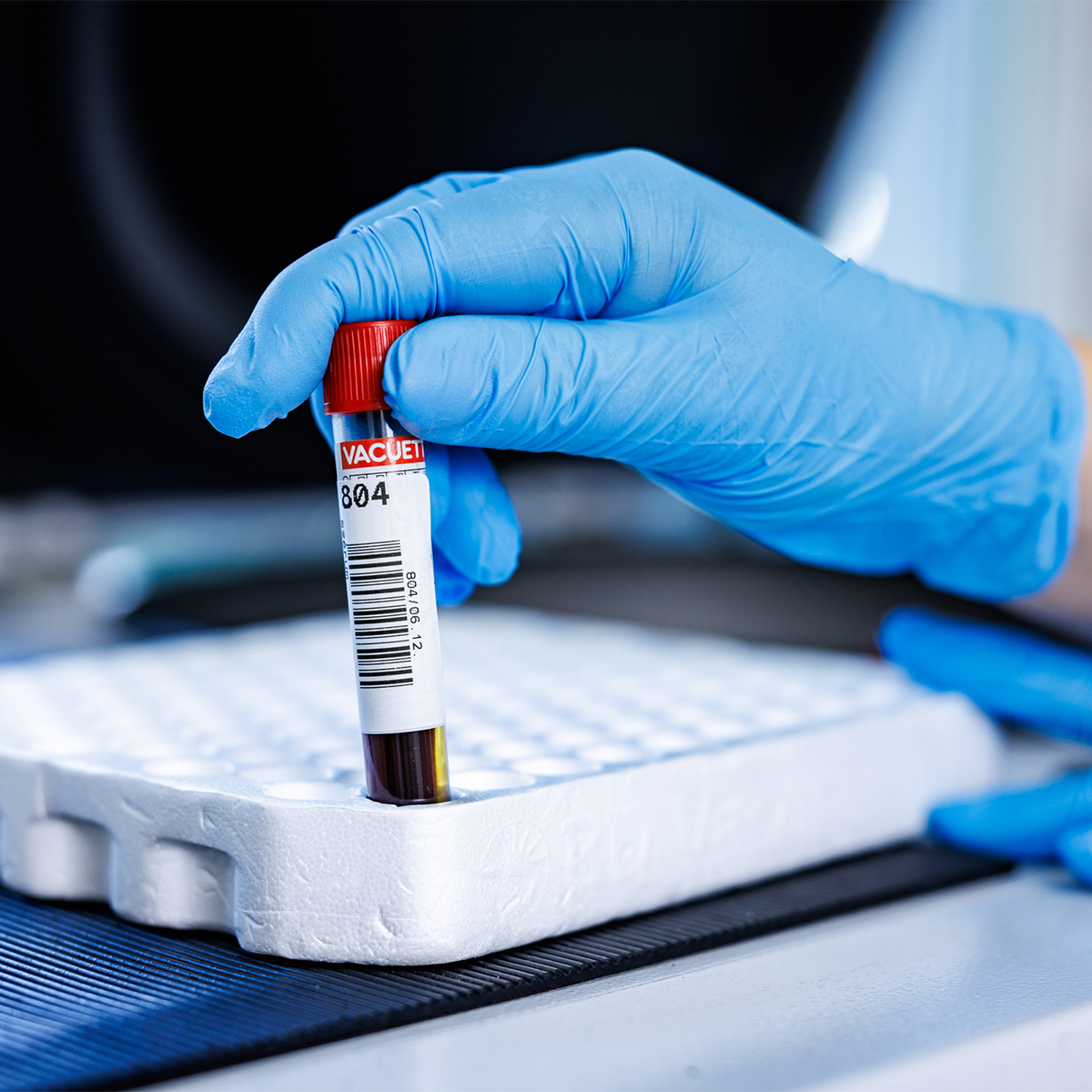 clinomicsdiag-alzon-alzheimer-vizsgalat-hogyan-tortenik